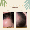 HairTry - Hydrate Hero - Loțiune hidratantă și calmantă pentru scalp cu complex NMF și ectoină - 100 ml
