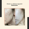 SkinTra - Destructor - Peeling acid pentru utilizare pe tot parcursul anului 24% - 30 ml