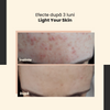 SkinTra – Light Your Skin – Ser cu vitamina C 20% și acid ferulic – 30 ml