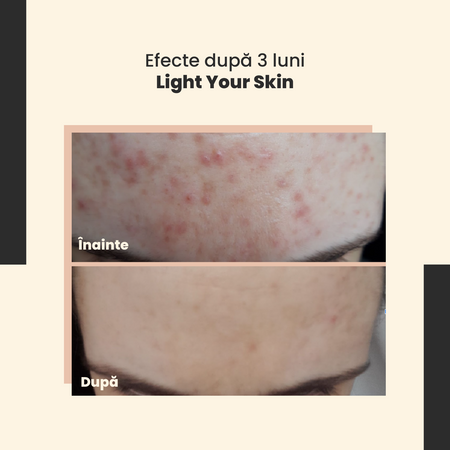 SkinTra – Light Your Skin – Ser cu vitamina C 20% și acid ferulic – 30 ml