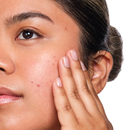 The Ordinary - Salicylic Acid 2% Solution - Ser cu acid salicilic - 30ml