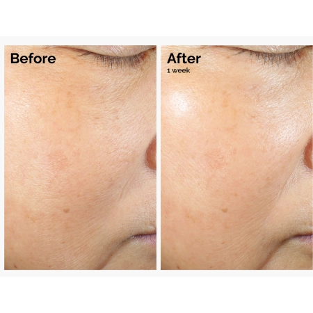 The Ordinary - Rice Lipids + Ectoin Microemulsion - Microemulsie cu lipide de orez și ectoină - 120 ml
