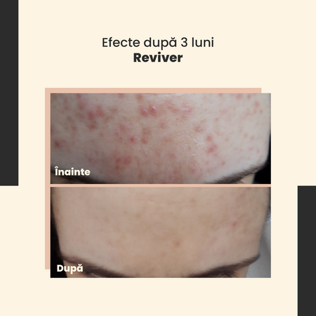 SkinTra – Reviver – Ser revitalizant – 30 ml